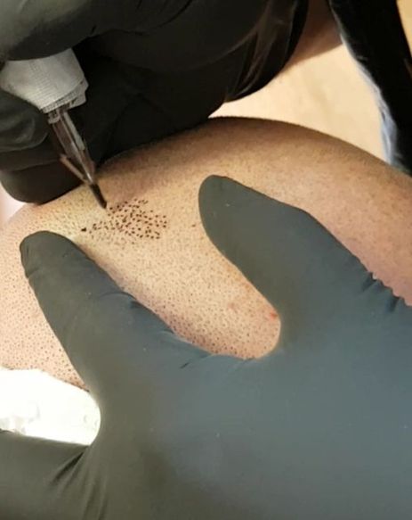 SMP pigment. Scalp Culture pigment. Karbonbasert pigment. Kvalitetspigment utviklet for hodebunnen. Trygt pigment.